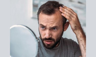 Stress-Induced Hair Fall: How Homeopathy Offers Natural Solution