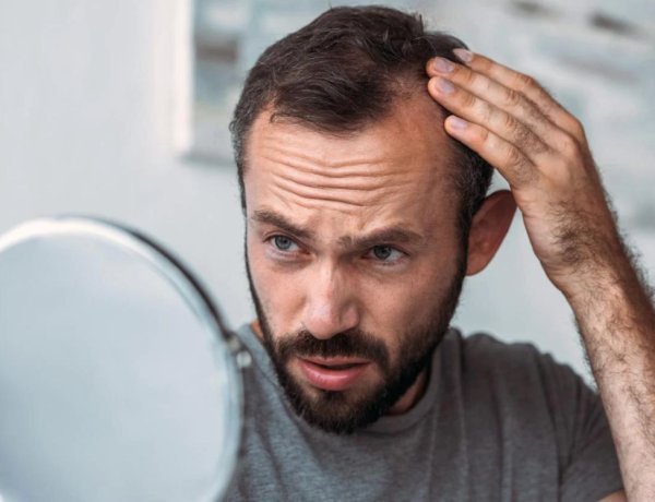 Stress-Induced Hair Fall: How Homeopathy Offers Natural Solution