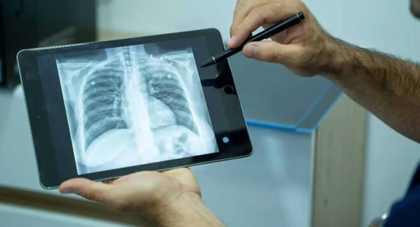 India has made Indigenous X-ray machine for testing TB with half of the price