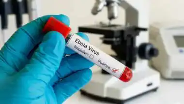 Ebola Watch: Air Suvidha Portal Activated as India Monitors Arrivals From High-Risk Countries